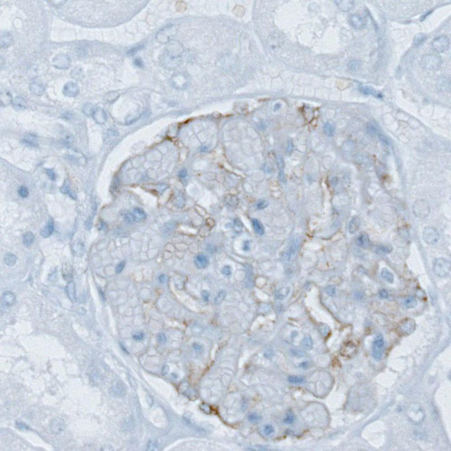 PLA2R1 Antibody in Immunohistochemistry (IHC)