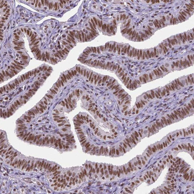 ATRX Antibody in Immunohistochemistry (IHC)