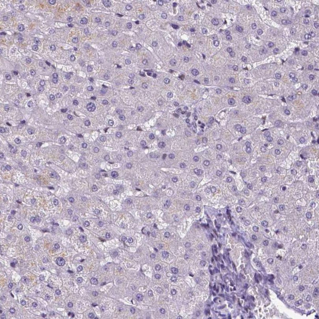 ATRX Antibody in Immunohistochemistry (IHC)