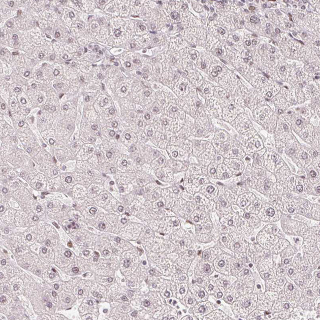 ZNF703 Antibody in Immunohistochemistry (IHC)