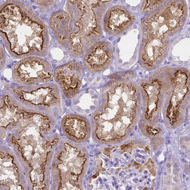 SLC22A2 Antibody in Immunohistochemistry (IHC)