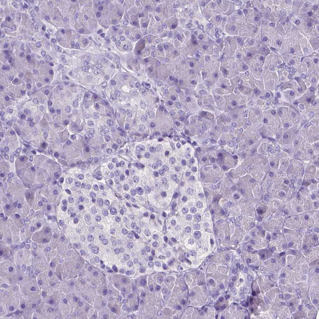 SLC22A2 Antibody in Immunohistochemistry (IHC)