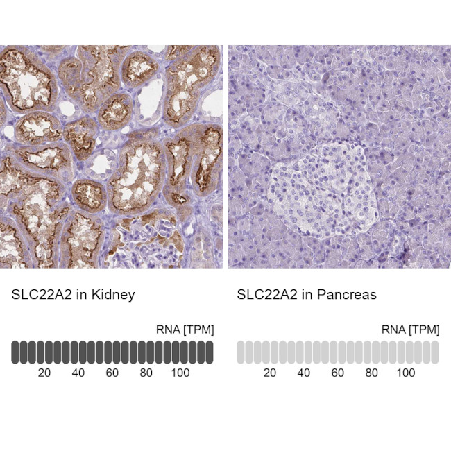 SLC22A2 Antibody