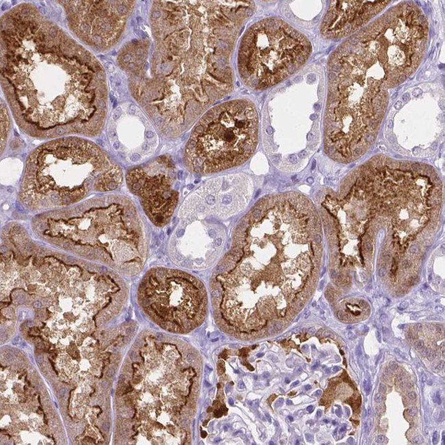 SLC22A2 Antibody in Immunohistochemistry (IHC)