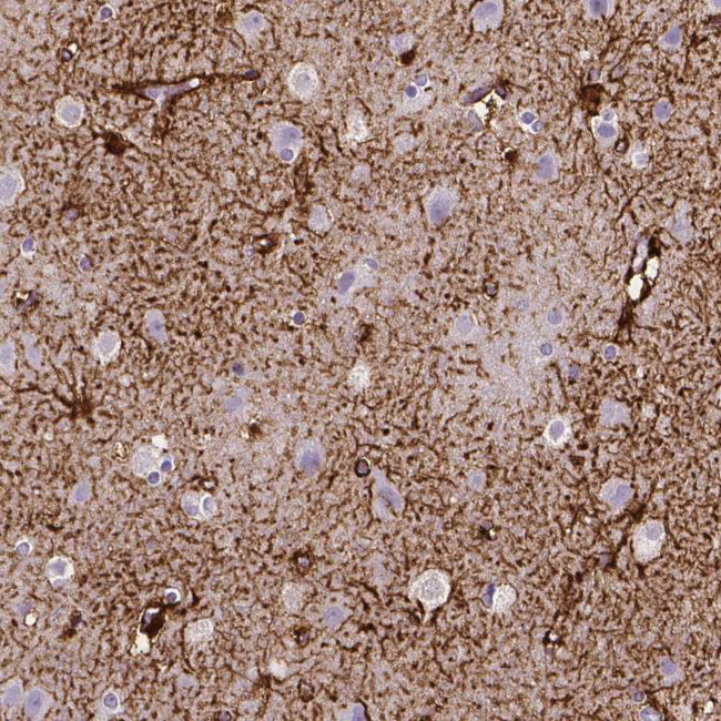 SLC22A2 Antibody in Immunohistochemistry (IHC)