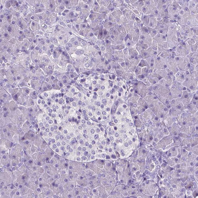 SLC22A2 Antibody in Immunohistochemistry (IHC)