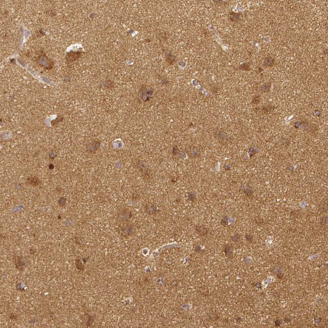 RHOT1 Antibody in Immunohistochemistry (IHC)