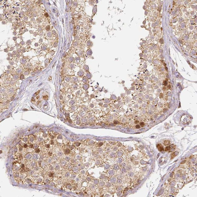 RHOT1 Antibody in Immunohistochemistry (IHC)