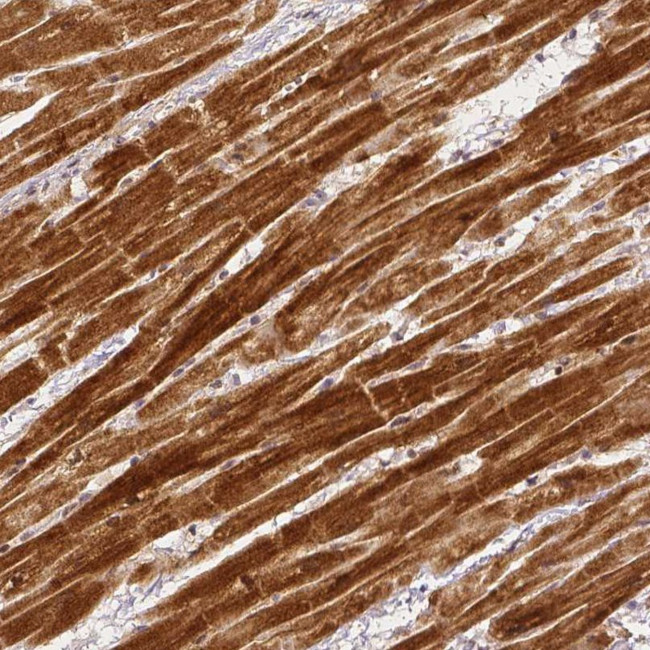 RHOT1 Antibody in Immunohistochemistry (IHC)