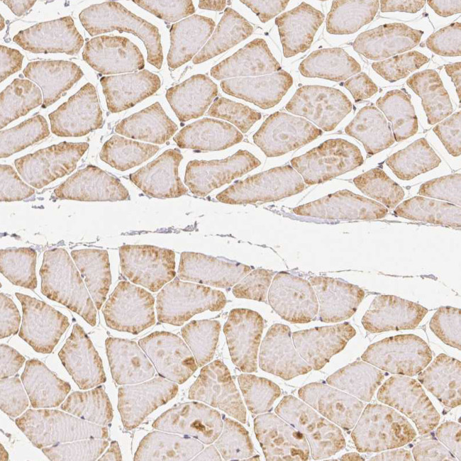 RHOT1 Antibody in Immunohistochemistry (IHC)