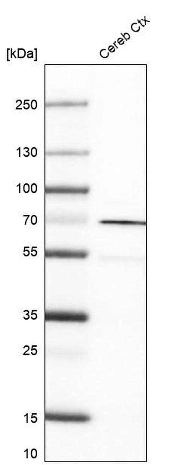 RHOT1 Antibody in Western Blot (WB)