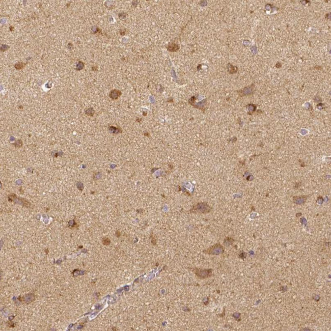 RHOT1 Antibody in Immunohistochemistry (IHC)