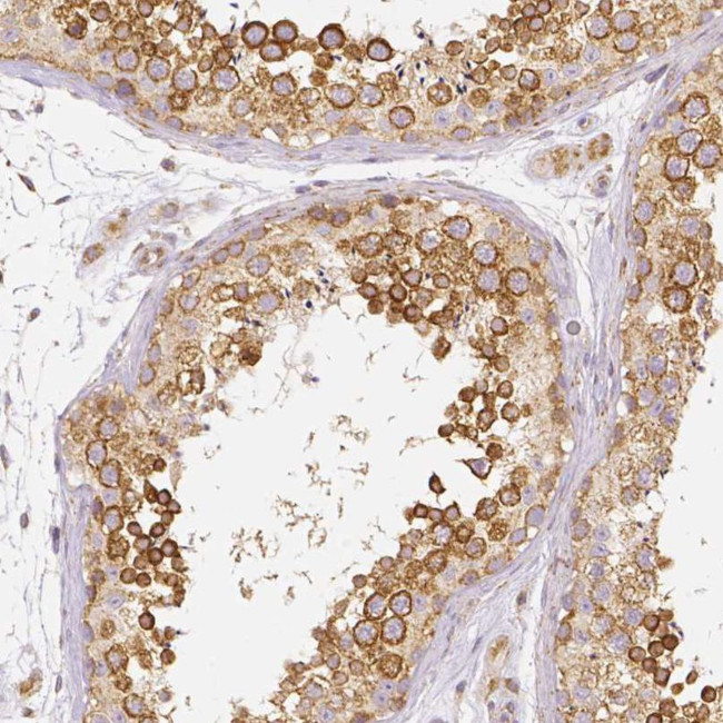 RHOT1 Antibody in Immunohistochemistry (IHC)