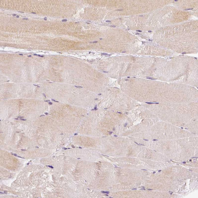 RHOT1 Antibody in Immunohistochemistry (IHC)