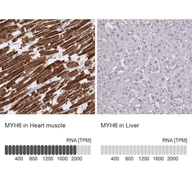 MYH6 Antibody in Immunohistochemistry (IHC)