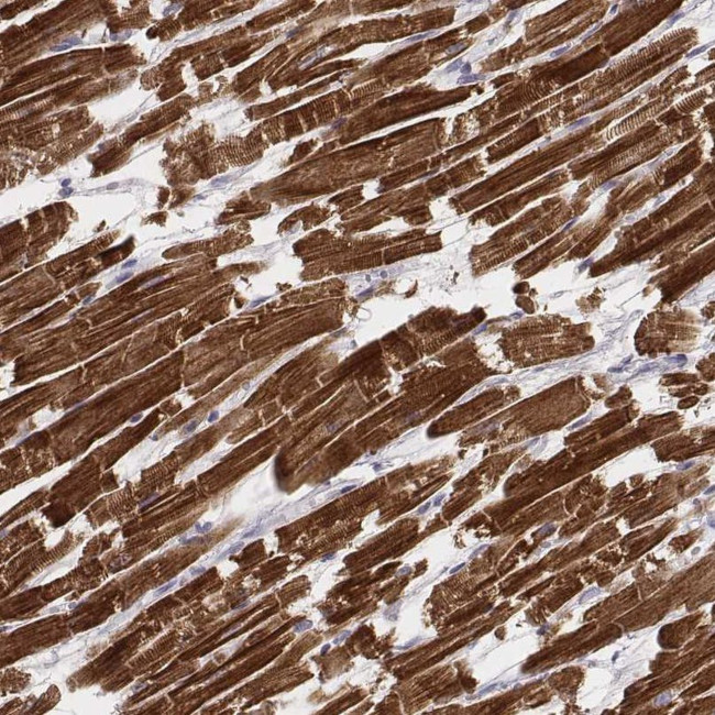 MYH6 Antibody in Immunohistochemistry (IHC)