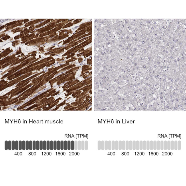 MYH6 Antibody in Immunohistochemistry (IHC)