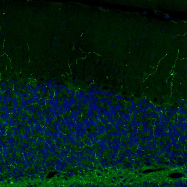 Norepinephrine Transporter Antibody in Immunohistochemistry (IHC)