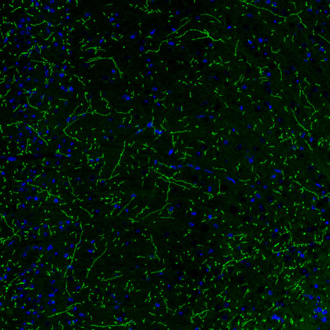 Norepinephrine Transporter Antibody in Immunohistochemistry (IHC)