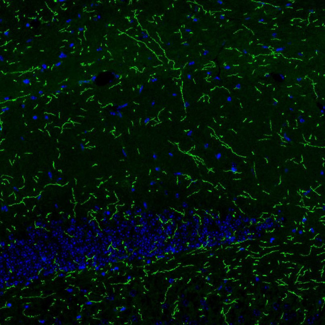 Norepinephrine Transporter Antibody in Immunohistochemistry (IHC)