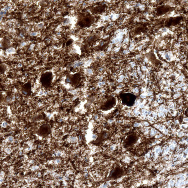 Norepinephrine Transporter Antibody in Immunohistochemistry (IHC)