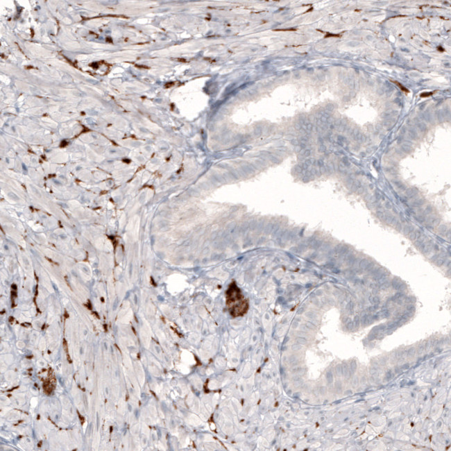 Norepinephrine Transporter Antibody in Immunohistochemistry (IHC)