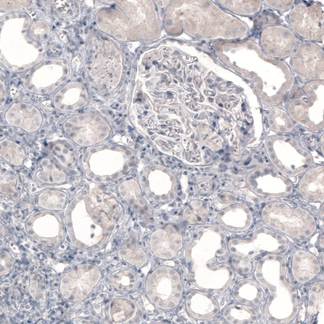 Norepinephrine Transporter Antibody in Immunohistochemistry (IHC)