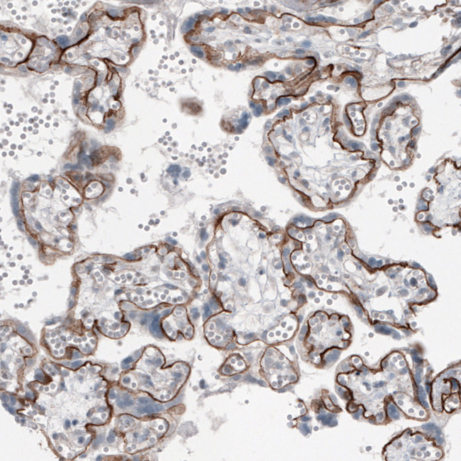 Laminin alpha-5 Antibody in Immunohistochemistry (IHC)