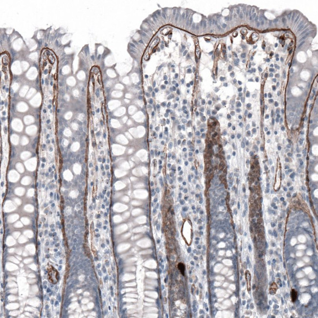 Laminin alpha-5 Antibody in Immunohistochemistry (IHC)