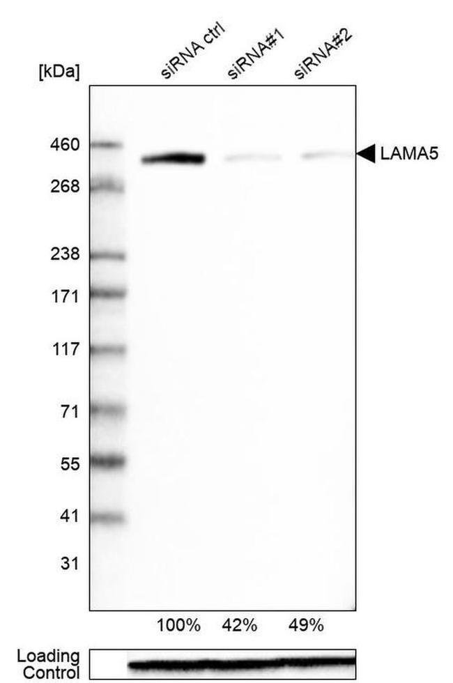 Laminin alpha-5 Antibody in Western Blot (WB)