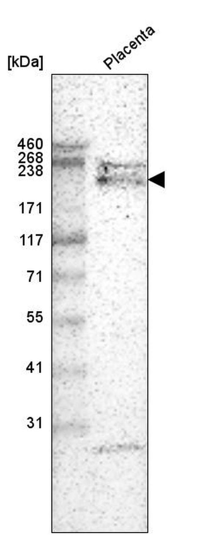 Laminin alpha-4 Antibody in Western Blot (WB)