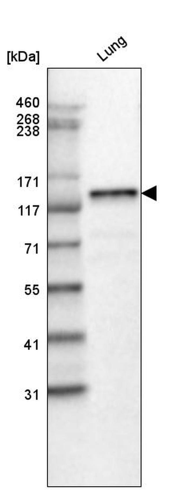 Laminin beta-3 Antibody in Western Blot (WB)