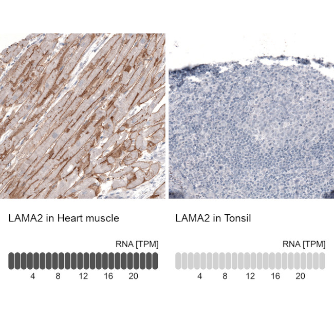 Laminin alpha-2 Antibody in Immunohistochemistry (IHC)