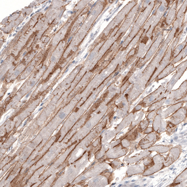 Laminin alpha-2 Antibody in Immunohistochemistry (IHC)