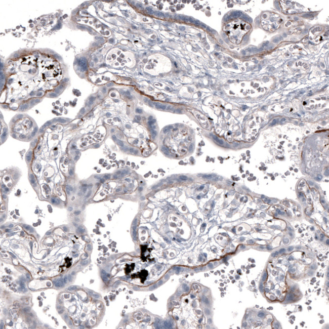 Laminin alpha-2 Antibody in Immunohistochemistry (IHC)