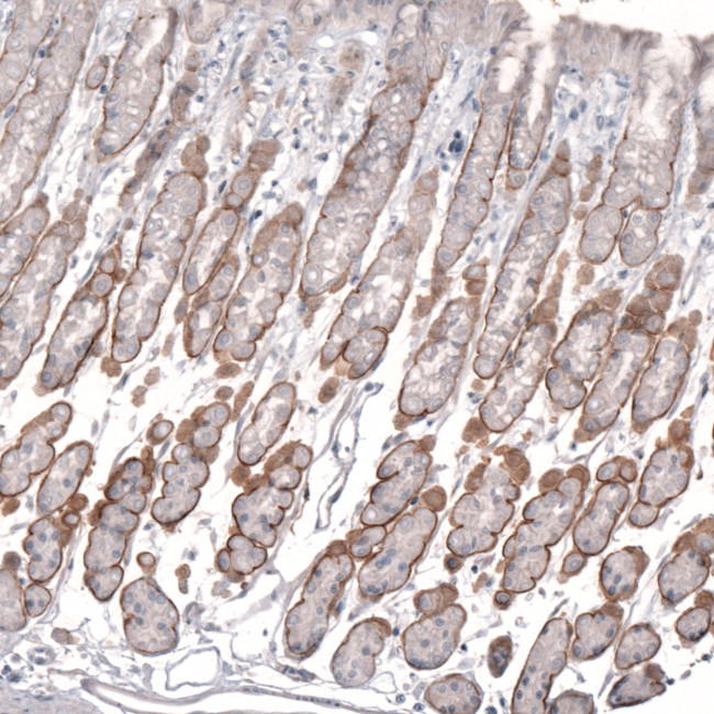 Laminin alpha-2 Antibody in Immunohistochemistry (IHC)