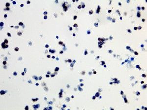 B-Raf (V600E) Antibody in Immunohistochemistry (Paraffin) (IHC (P))