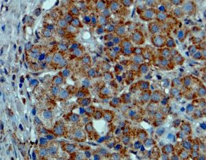 B-Raf (V600E) Antibody in Immunohistochemistry (Paraffin) (IHC (P))