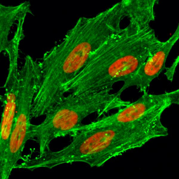 H2A.ZK7ac Antibody in Immunocytochemistry (ICC/IF)