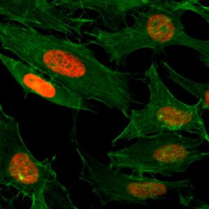 H3K4ac Antibody in Immunocytochemistry (ICC/IF)