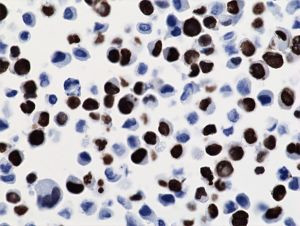 H3 K36M oncohistone mutant Antibody in Immunocytochemistry (ICC/IF)