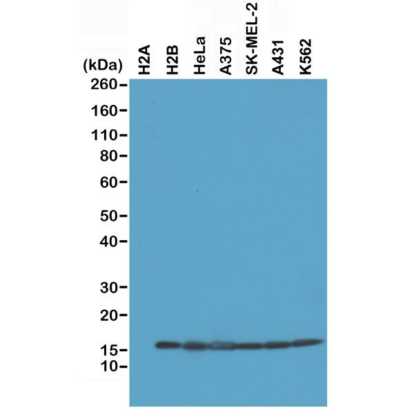 Histone H2B Antibody in Western Blot (WB)