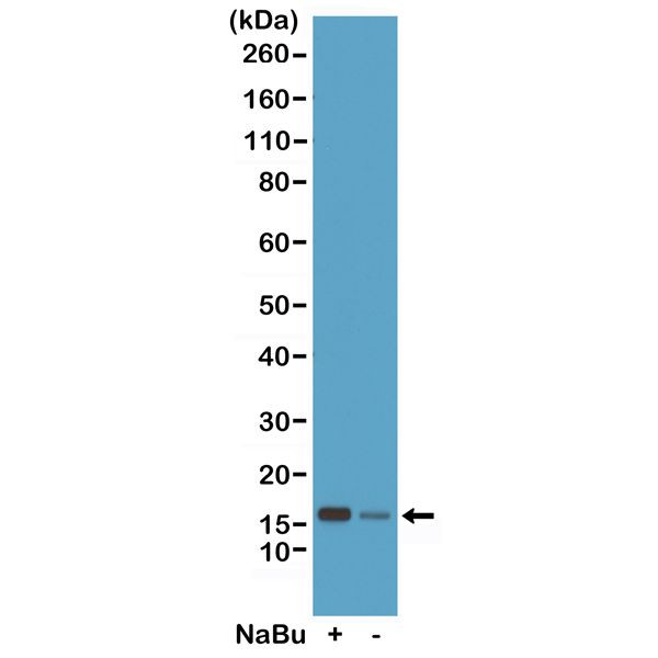 H2BK20ac Antibody in Western Blot (WB)