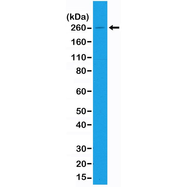 Acetyl-CoA Carboxylase Antibody in Western Blot (WB)