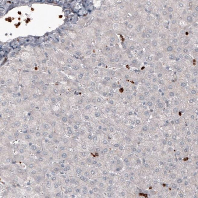 VISTA Antibody in Immunohistochemistry (IHC)