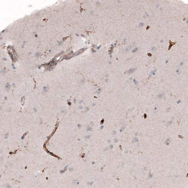 VISTA Antibody in Immunohistochemistry (IHC)