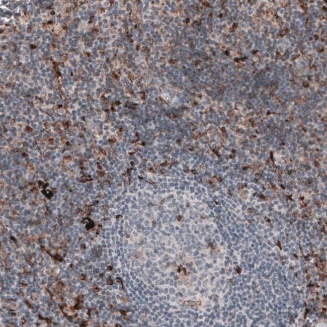 VISTA Antibody in Immunohistochemistry (IHC)