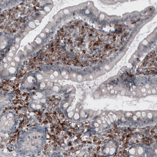 VISTA Antibody in Immunohistochemistry (IHC)