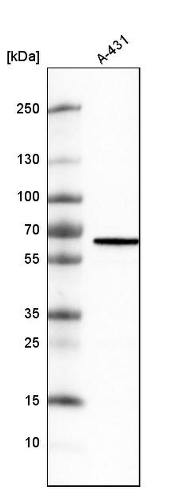 METTL14 Antibody in Western Blot (WB)