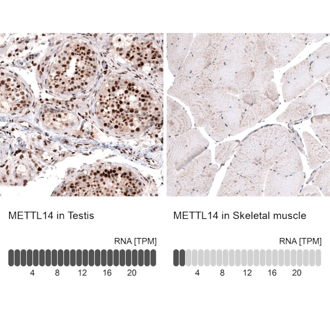 METTL14 Antibody